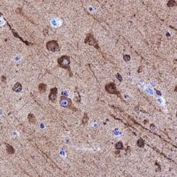 LC3A Antibody (2312D) - Azide and BSA Free, Novus Biologicals 0.1 mg; Unconjugated:Antibodies,